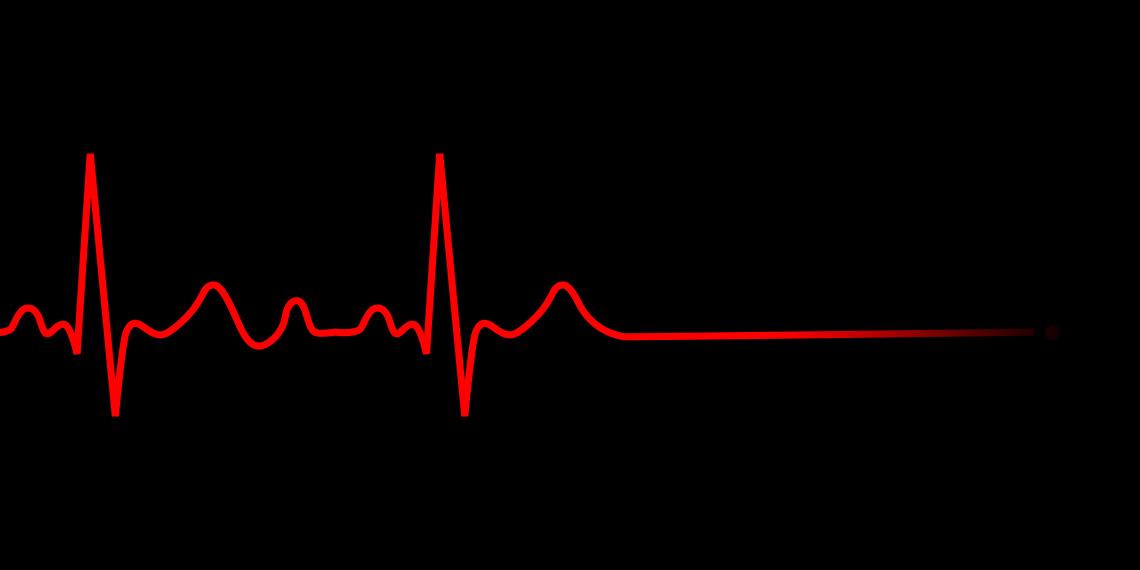 ECG flatline